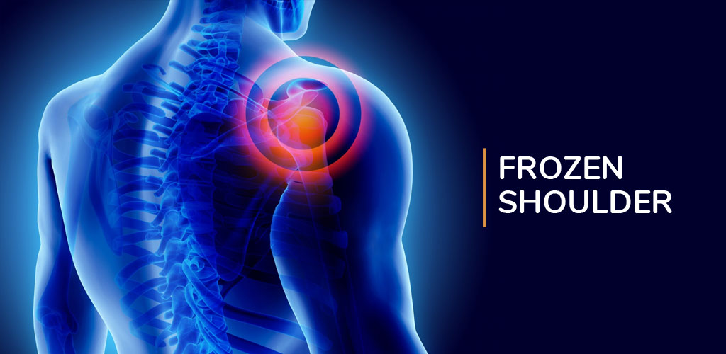 Frozen Shoulder Treatment in Phursungi | Frozen Shoulder Specialist in Phursungi