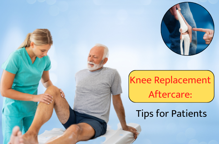 Knee Replacement Aftercare:
