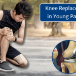 Knee Replacement in Young Patients